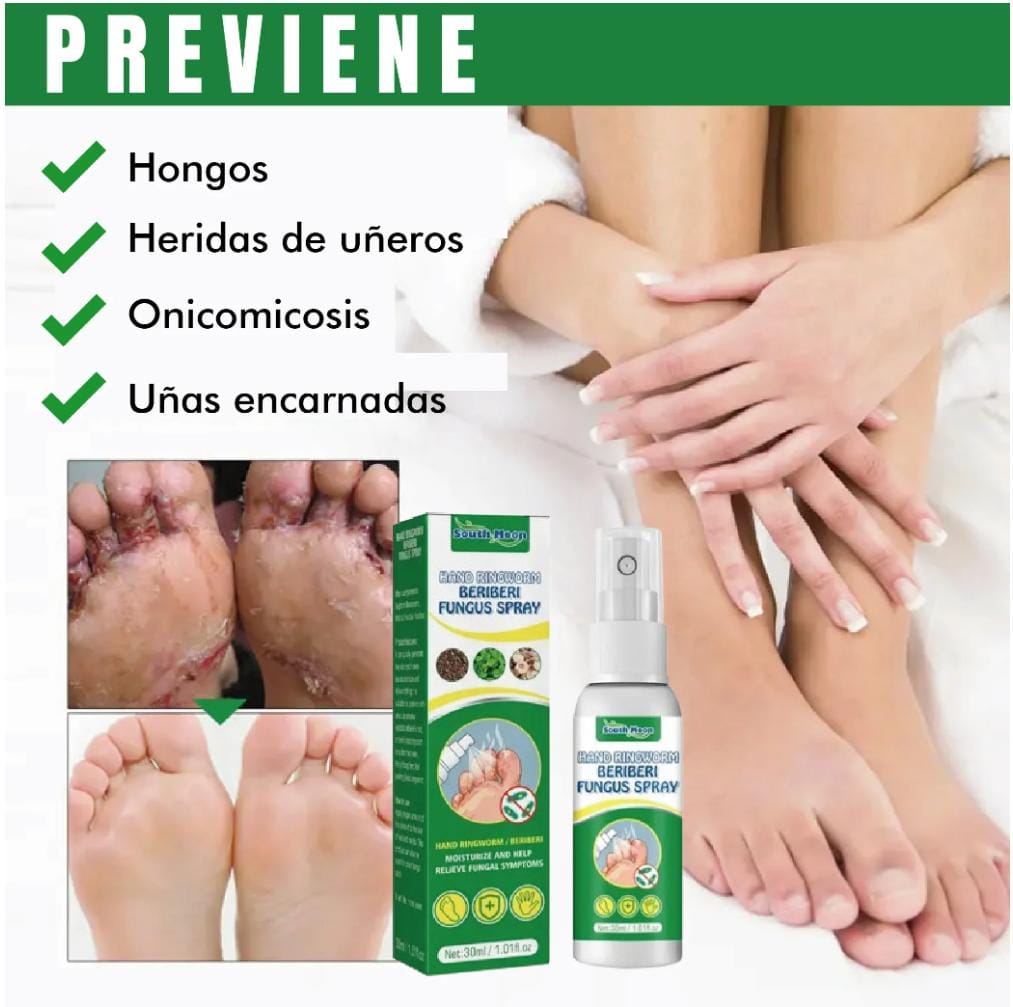 Spray AntiHongos