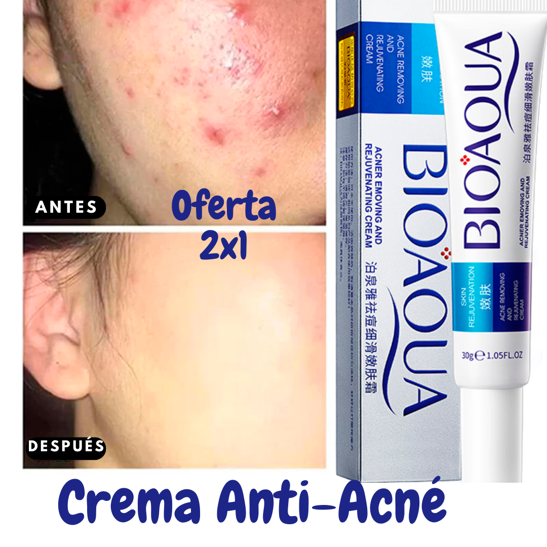 (2x1) Crema Anti Acné "Bioaqua" Lleva 2 Cremas
