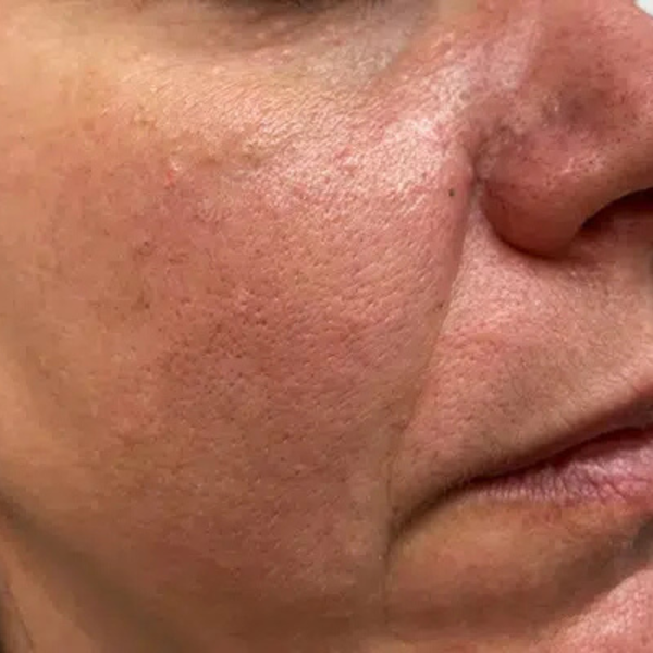 Suero Facial Piel Radiante