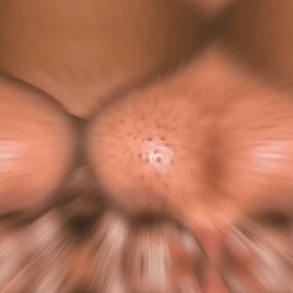 Limpieza Ultrasónica Facial