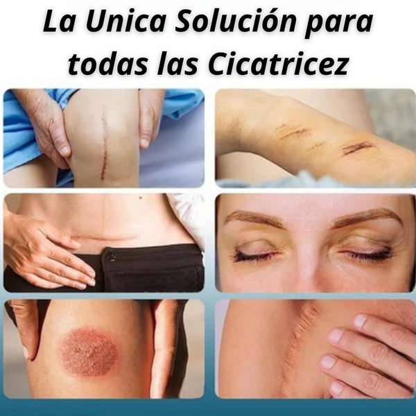 Gel Avanzado para Cicatrices