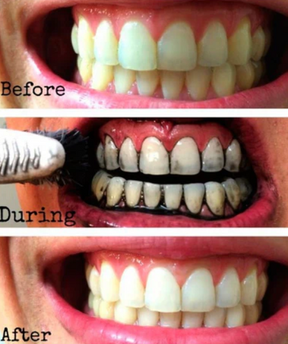 Blanqueador Dental Miracle Teeth Carbón Activado