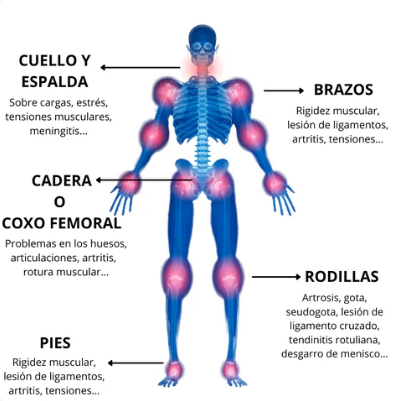 Parches Terapeuticos para el Alivio de Rodillas y Articulaciones