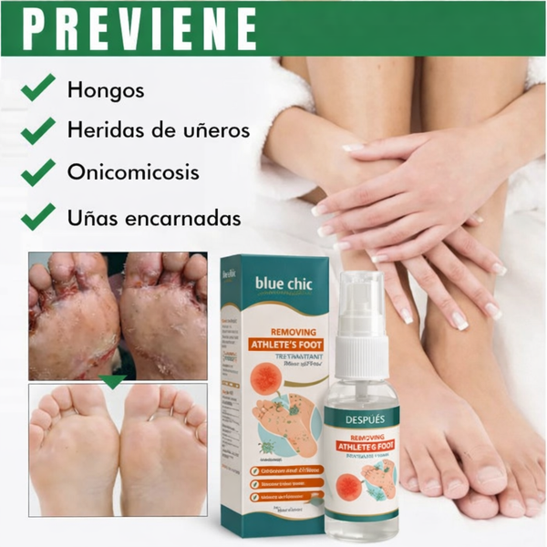 Spray AntiHongos Pies Salud