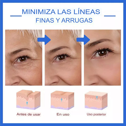 Serum Anti-Envejecimiento