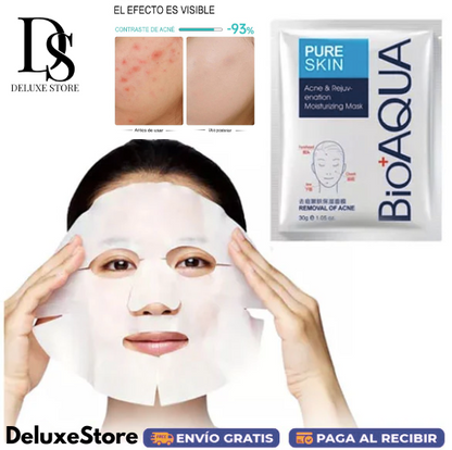 Mascariila Anti Acné Bioaqua (5 Mascarillas)