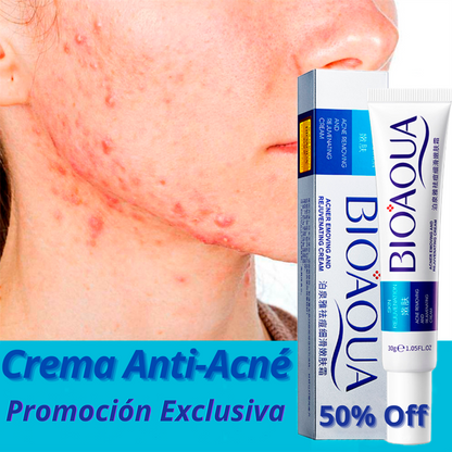 (2x1) Crema Anti Acné "Bioaqua" Lleva 2 Cremas