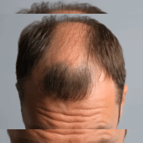 Batana Aceite Repara Cabello Masculino