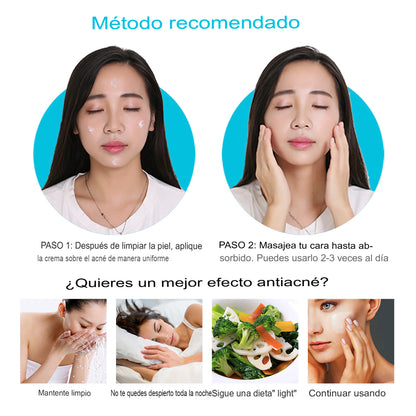 (2x1) Crema Anti Acné "Bioaqua" Lleva 2 Cremas