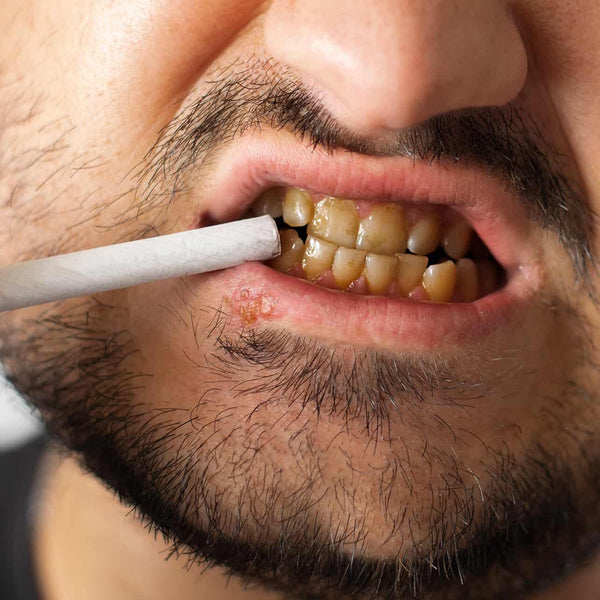Sonrisa Brillante para Fumadores Diario