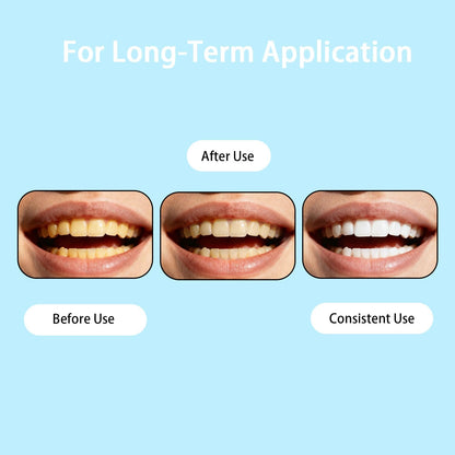 Armadura Esmalte Dental Radiante Instantánea