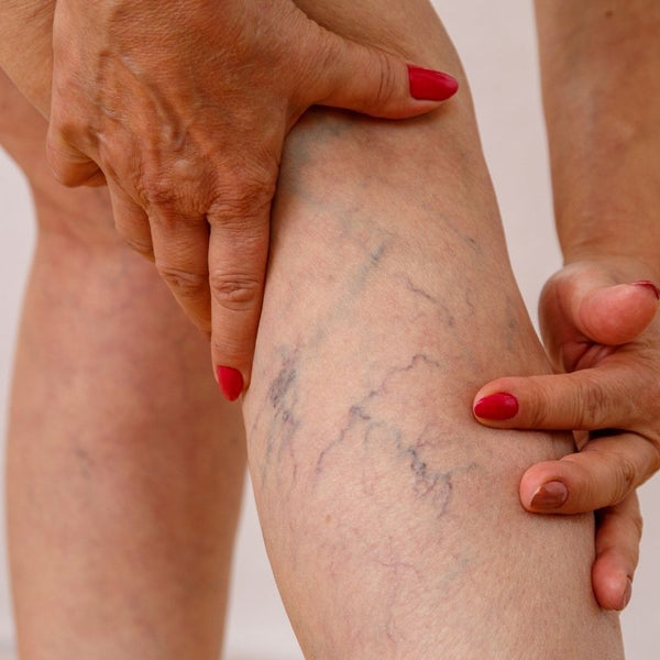 Crema Reparadora Piernas Vivas